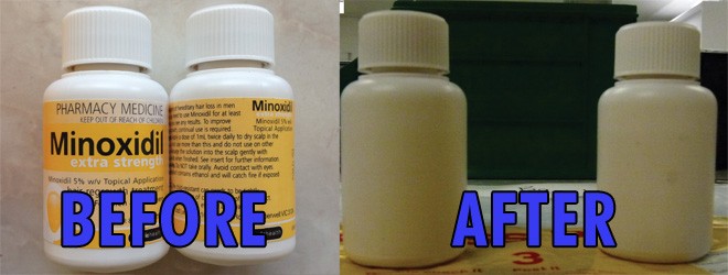 IHRB caught illegally selling Minoxidil by peeling labels